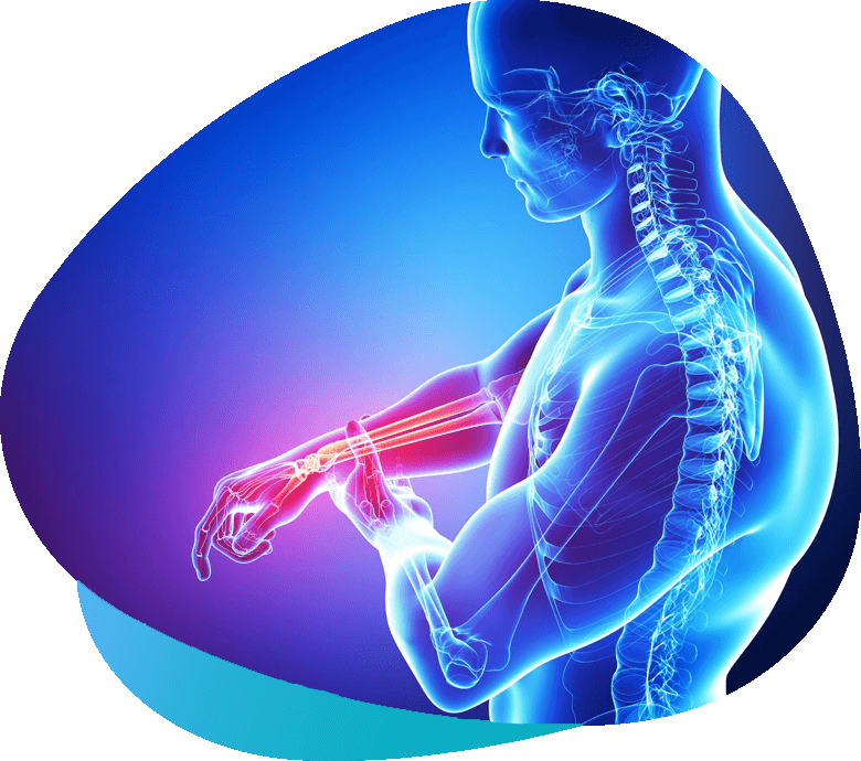 Complex Regional Pain Syndrome (CRPS)