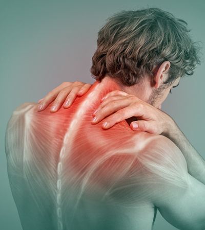 Myofascial Pain Syndrome