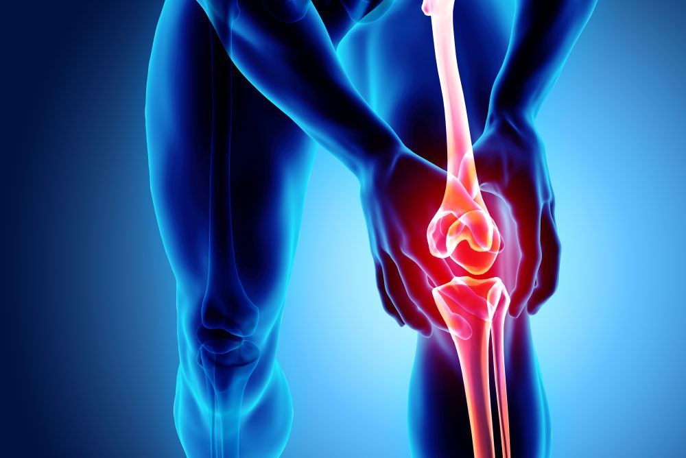 Osteoarthritis