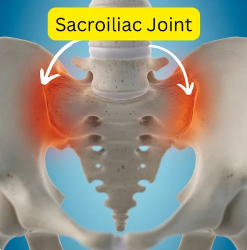 Sacroiliac Joint Pain
