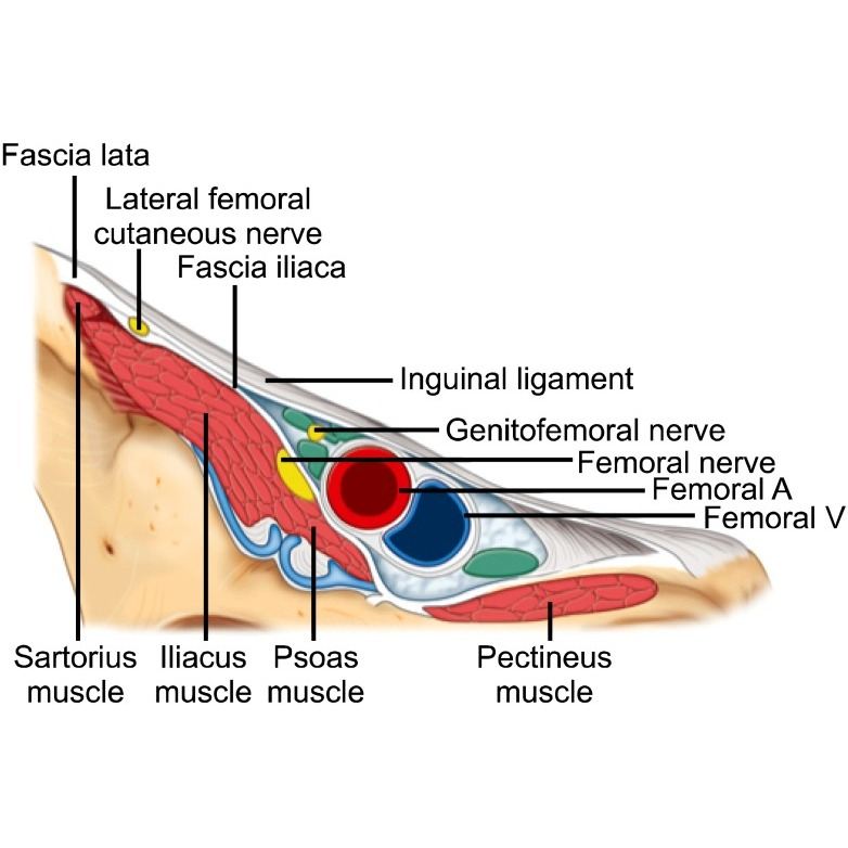 Ilioinguinal Nerve, Iliohypogastric Nerve, Genitofemoral Nerve Block