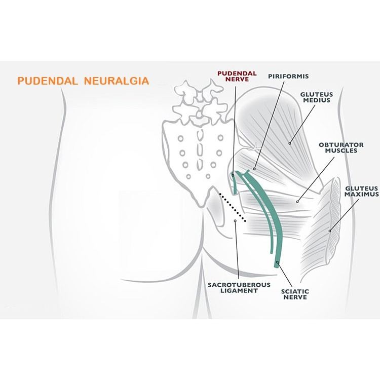 Pudendal Nerve Block